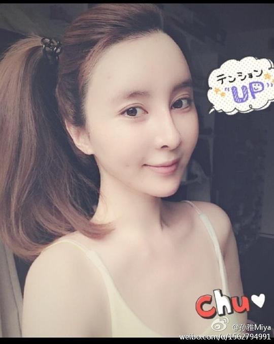 孙雅 Ya sun