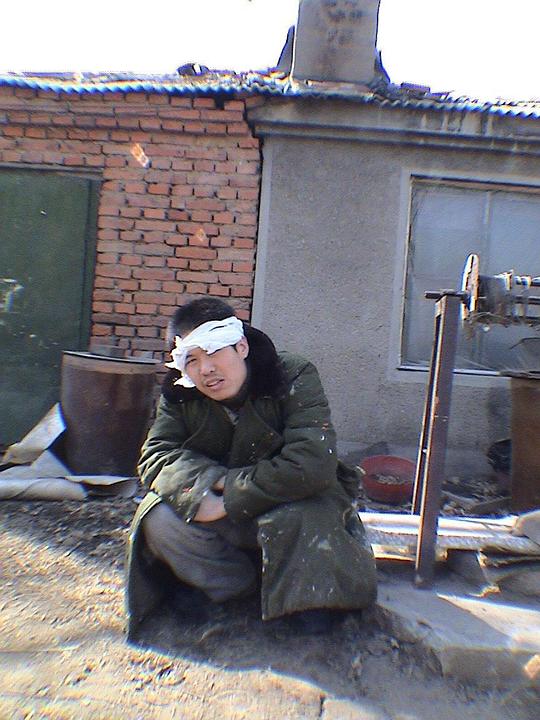 李会 Hui Li
