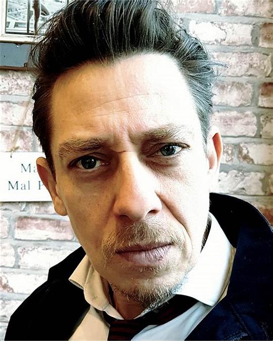 米尔顿·威尔士 Milton Welsh