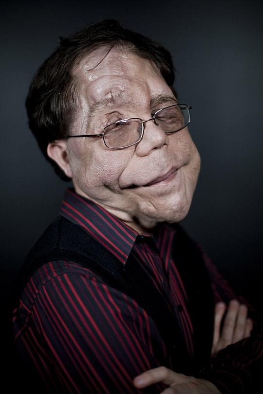 亚当·皮尔森 Adam Pearson