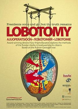 脑白质切除术 Lobotomiya