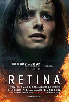 视网膜 Retina