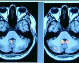 地平线系列：记忆的实现 Horizon: How Does Your Memory Work?