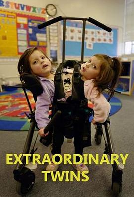 连体双胞胎 第一季 Extraordinary Twins Season 1