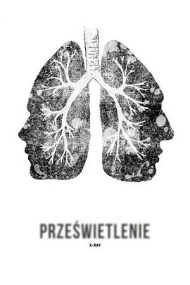X射线 Prześwietlenie